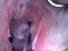 Cum Injection with Syringe in Cervix Uterus after Penetrating