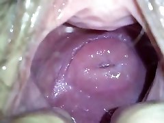 my japanese girlfend's super-cute cervix in massive hole