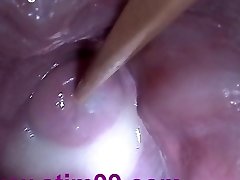 Insertion Semen Cum in Cervix Broad Stretching Snatch Speculum