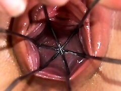 Gyno gaping of beautiful czech babe Gyno gaping of beautiful czech babe