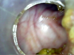 Deep deep anal again home colonoscopy Endoscope Part 1