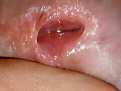 preparar al pollito para la inserción del tubo con el suero anestésico preparar al pollito para la inserción del tubo con el suero anestésico