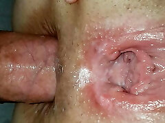 bbw culo estiramiento y coño enorme bbw culo estiramiento y coño enorme