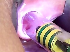 Woman Pee Slot Playing Urethral Insertion with Endoscope Cam