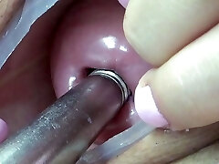 Lesbian pee inside the Uterus of other with tube in PeeHole
