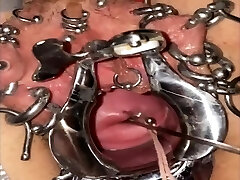 Extreme cervix sounding Extreme cervix sounding