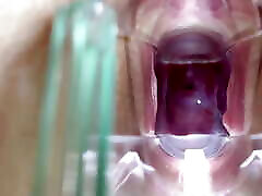 Stella St. Rose - Extreme czech hd pov Views and Juices Flowing Using a Speculum