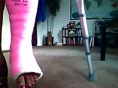 cast xxx videospornode - broken ankle