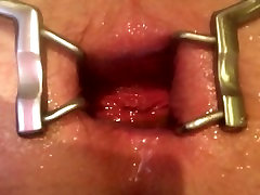 Anal spreader Anal spreader