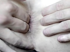 Closeup of anal fingering, perhaps too close, my anus takes half the screen Closeup of anal fingering, perhaps too close, my anus takes half the screen