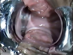 अत्यधिक सींग का बना हुआ japanese creampie jk रोग smoll wwww वीक्षक सम्मिलित करता है में अपने मरीज की चूत
