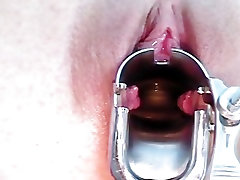 Shandi getting her pussy release in side speculum examined