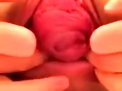 Vaginal And Anal Prolapse On Webcam -