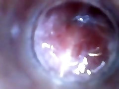 look inside my cock endoscope with test tube introducing cam