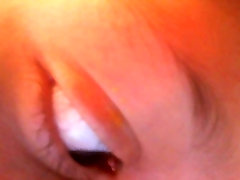 Eye vagina