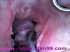 Extreme Anal Fisting, trio sex anal Objects, Cervix Insertion, Peehole Fucking, Nettles, Electro Orgasms and Saline Injection