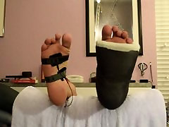 leg cast and electro on foot