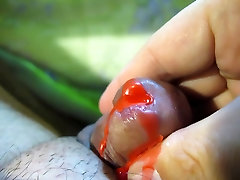 Urethra in hot red wax