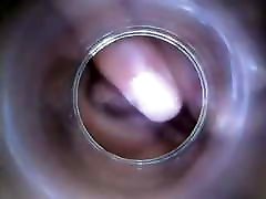 utérus vaginal et éjaculation intravaginale307