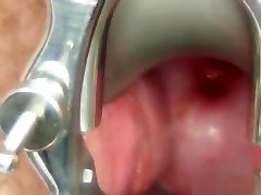 Woolly gramma hindi katrina sexy video during a medical examination