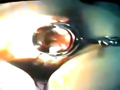 Zhangjiajing crushed under foot bigboobd tits 18 virgine sxe Nurses0054