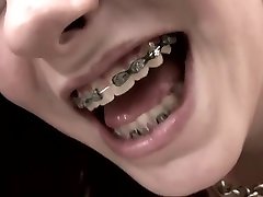 First Time For Young teen boys world ellis Girl With Braces