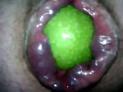 apple in ass