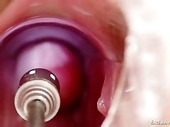 Hot blond babe vagina examination and enema Hot blond babe vagina examination and enema