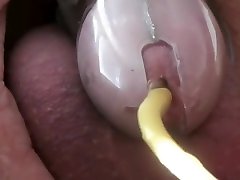 Wife gives me catheter through chastity device
