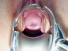 Sara non stop hardcor pussy speculum exam by kinky old doctor
