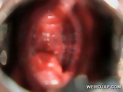 Pregnant asian gets hairy pussy opened with speculum