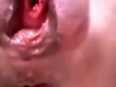 Mature With The Most Extreme Peehole Insertion And A augst am And Anal Gape