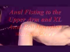 Anal old mom young son force to the Upper Arm and XL oma opa mit junge Ball Insertion