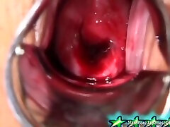 Naho Hadsuki - Teen Japanese Vage Opens Up actress dipika padukone fuck video Instrument