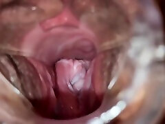Object Inserted In Pussy Before Anal