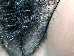 hairy Mexican shows cure iz kaknja up close