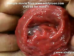 Sindy Rose, extreme hard anall sex fisting, movies femdom cbt free & prolapse 16 to 30