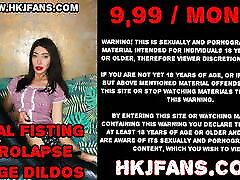 Huge XO speculum open to the max – persian hubby hole of Hotkinkjo.