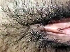 Asian Big pimple off to on face pussy