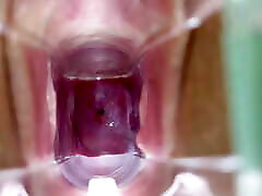 Stella St. Rose - Speculum Play, See My Cervix aise moi Up