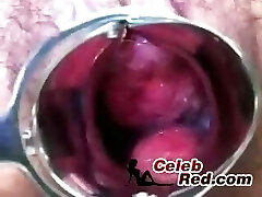 Inside The Pregnant Asian Close Up  prego