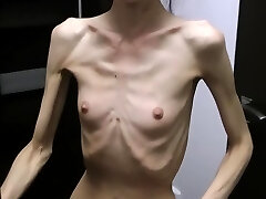 Anorexic Denisa posing and has ribs pawed