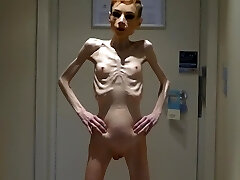 Anorexia Christin showing her Meatpipes & Skinny Skeleton