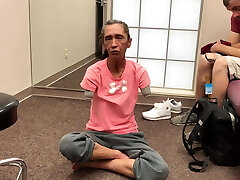 mature dual arm amputee