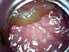 Buttfuck endoscope part 2