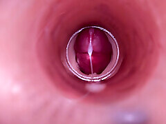 Female Insemination - Internal Camera Captures Deep Male Ejaculation