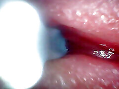 Endoscope camera captures moment of male ejaculation